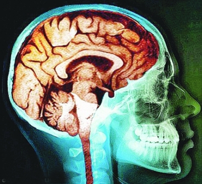 人脑智力从45岁开始下降